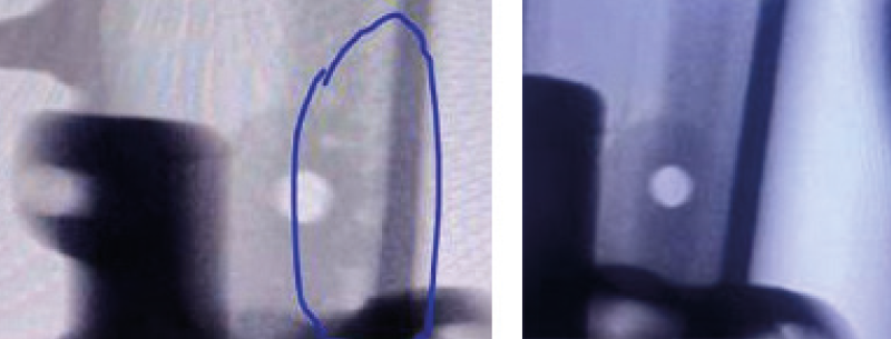 X射线检测铸件：左侧为原始的铸件，右侧为优化镶块之后的铸件 